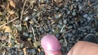 My little phimosis penis erects